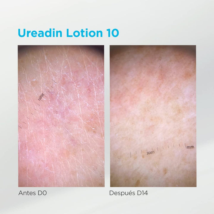 ISDIN Ureadin Lotion 10 (1000ml) | Loțiune de corp cu hidratare intensivă pentru pielea uscată 10% uree Copii - Baie si Skincare Naty Shop